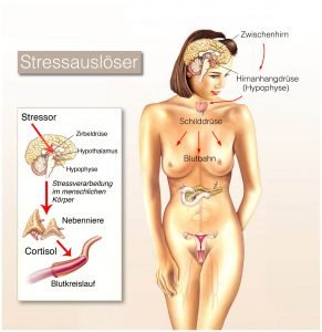 Zeichnung mit Stressauslösern